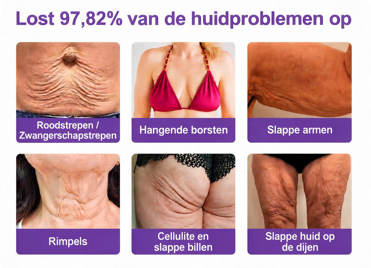 Natravor®🎗️ PDRN Multi-Peptide Massage Roller Crème – Anti-aging verzorging, hydratatie, versteviging & lifting voor een gladdere en egalere huid