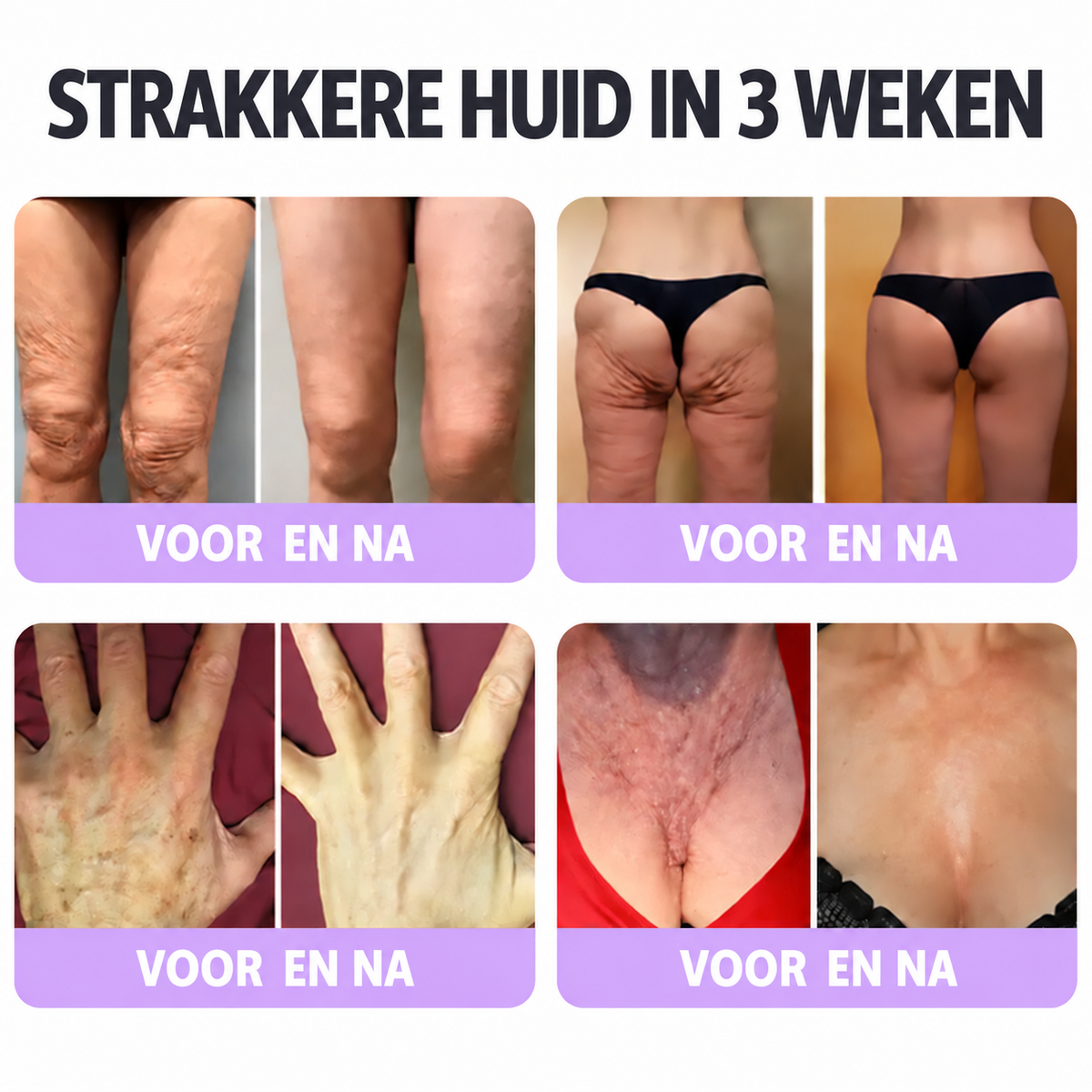 Natravor®🎗️ PDRN Multi-Peptide Massage Roller Crème – Anti-aging verzorging, hydratatie, versteviging & lifting voor een gladdere en egalere huid
