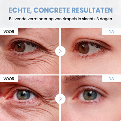 Natravor® PDRN Anti-Rimpel Booster – Liftende & Verstevigende Crème