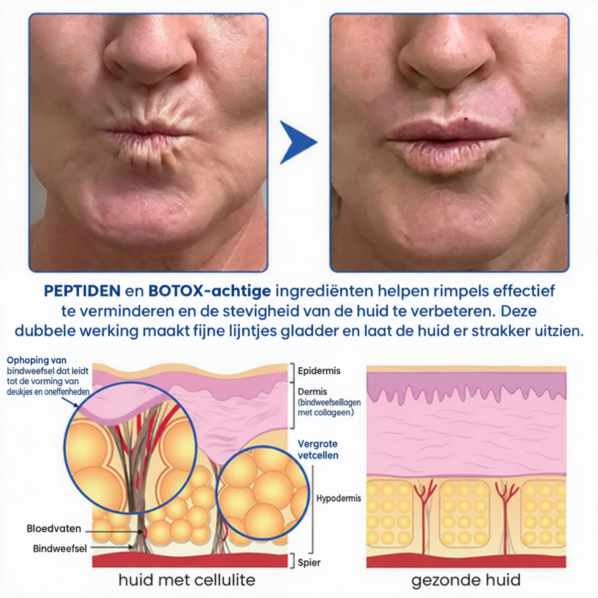 Natravor® PDRN Anti-Rimpel Booster – Liftende & Verstevigende Crème
