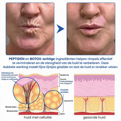 Natravor® PDRN Anti-Rimpel Booster – Liftende & Verstevigende Crème