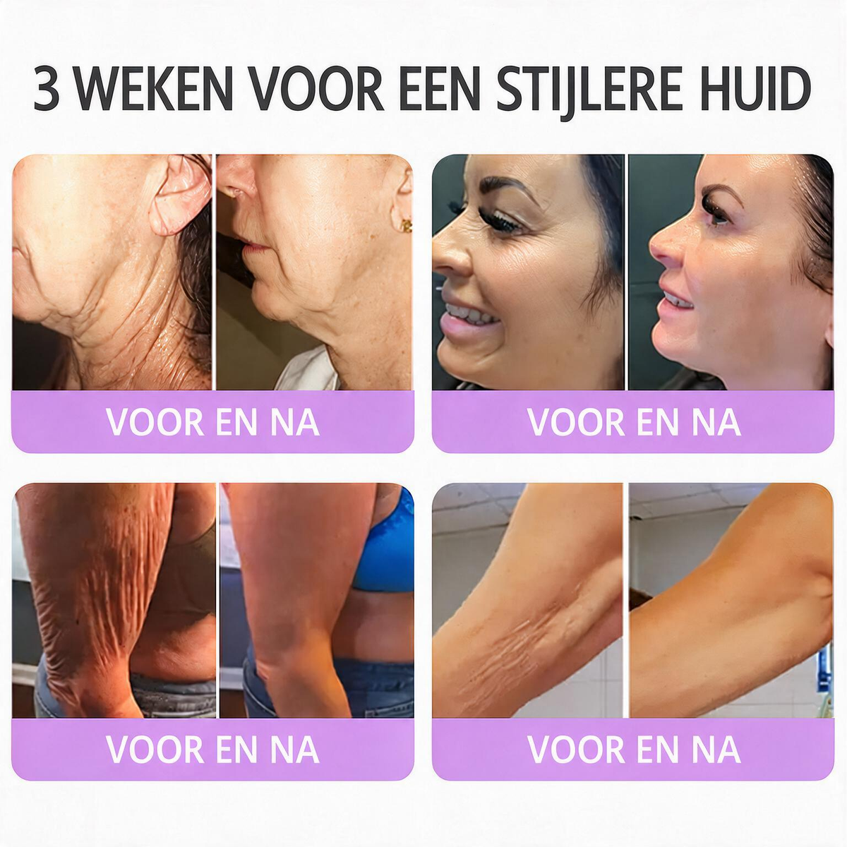 Natravor®🎗️ PDRN Multi-Peptide Massage Roller Crème – Anti-aging verzorging, hydratatie, versteviging & lifting voor een gladdere en egalere huid