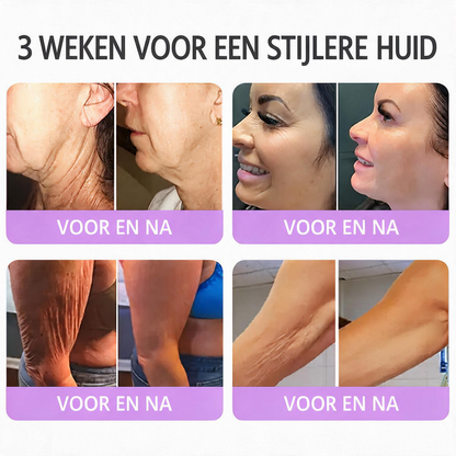 Natravor®🎗️ PDRN Multi-Peptide Massage Roller Crème – Anti-aging verzorging, hydratatie, versteviging & lifting voor een gladdere en egalere huid