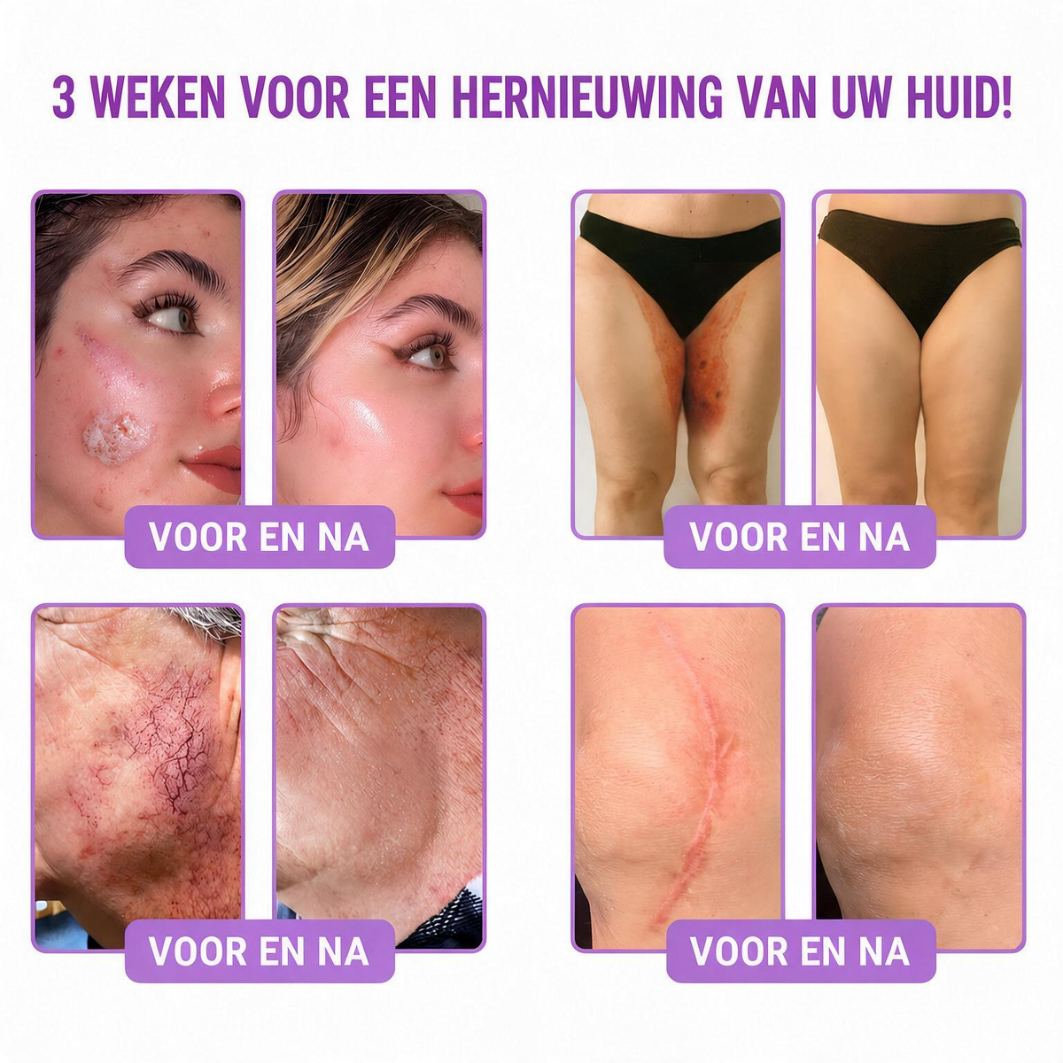 Natravor®🎗️ PDRN Multi-Peptide Massage Roller Crème – Anti-aging verzorging, hydratatie, versteviging & lifting voor een gladdere en egalere huid