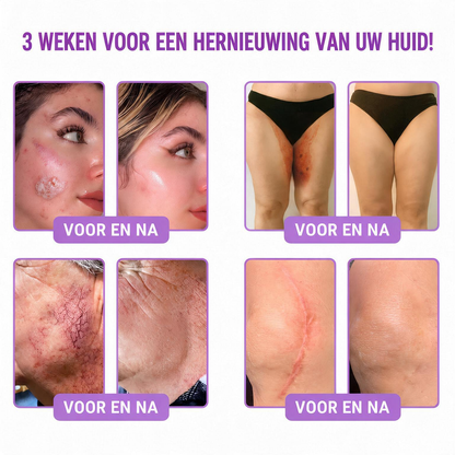 Natravor®🎗️ PDRN Multi-Peptide Massage Roller Crème – Anti-aging verzorging, hydratatie, versteviging & lifting voor een gladdere en egalere huid