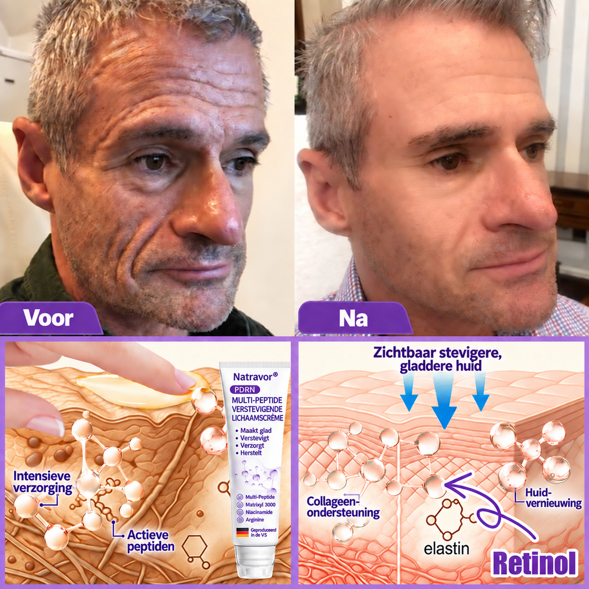 Natravor®🎗️ PDRN Multi-Peptide Massage Roller Crème – Anti-aging verzorging, hydratatie, versteviging & lifting voor een gladdere en egalere huid