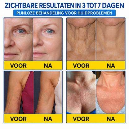 Natravor® PDRN Anti-Rimpel Booster – Liftende & Verstevigende Crème