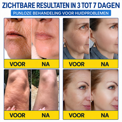 Natravor® PDRN Anti-Rimpel Booster – Liftende & Verstevigende Crème