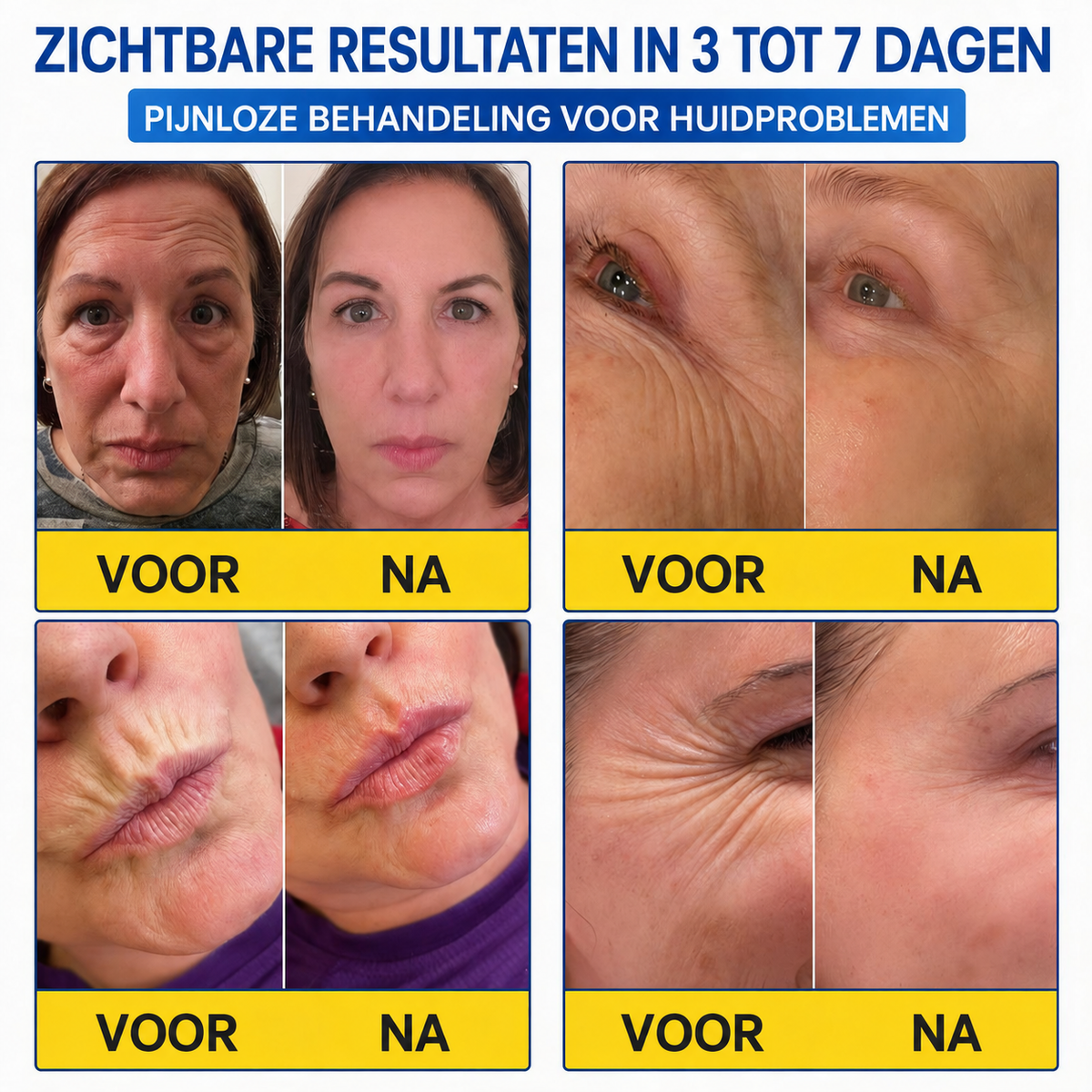 Natravor® PDRN Anti-Rimpel Booster – Liftende & Verstevigende Crème