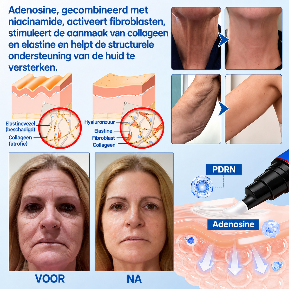 Natravor® PDRN Anti-Rimpel Booster – Liftende & Verstevigende Crème