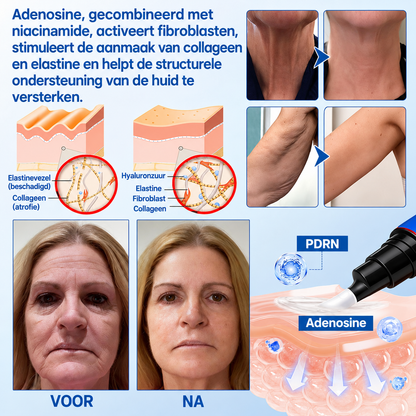 Natravor® PDRN Anti-Rimpel Booster – Liftende & Verstevigende Crème